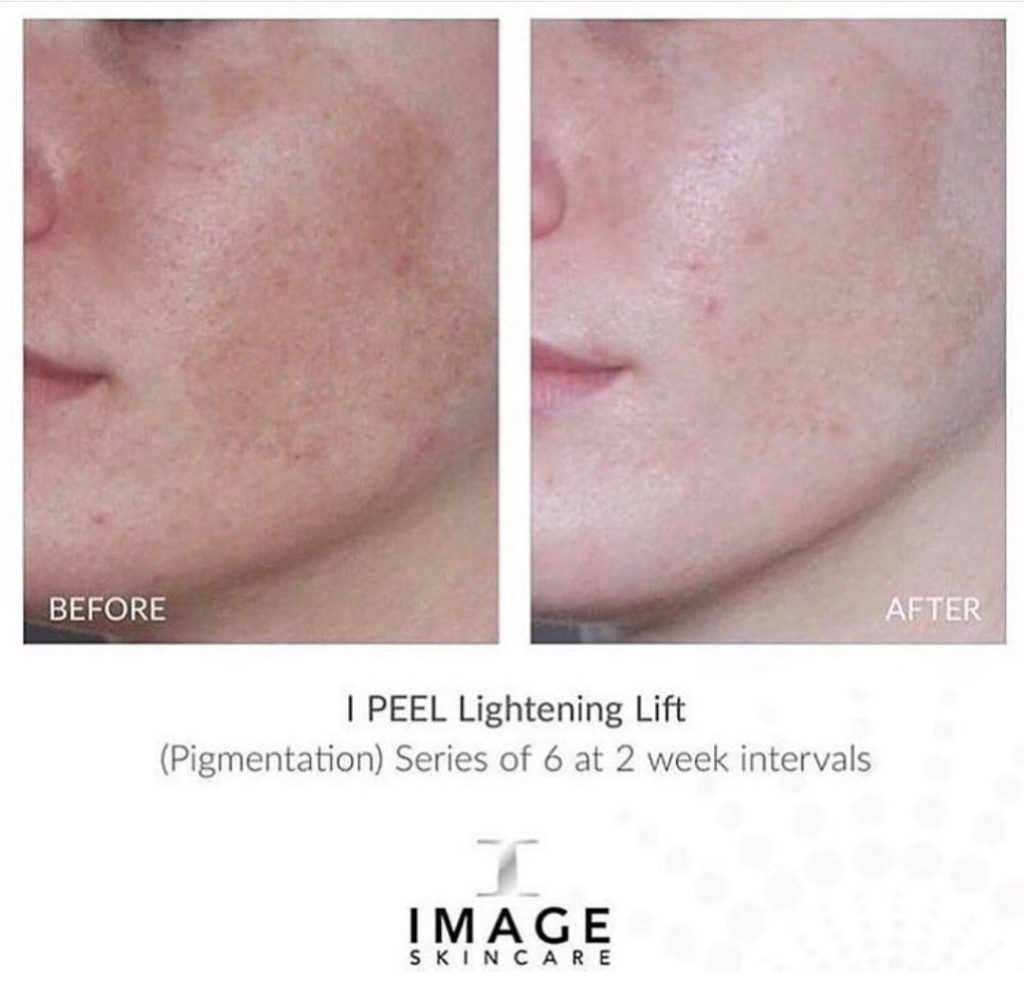 image skincare huidverbetering zichtbaar op 2 afbeeldingen
